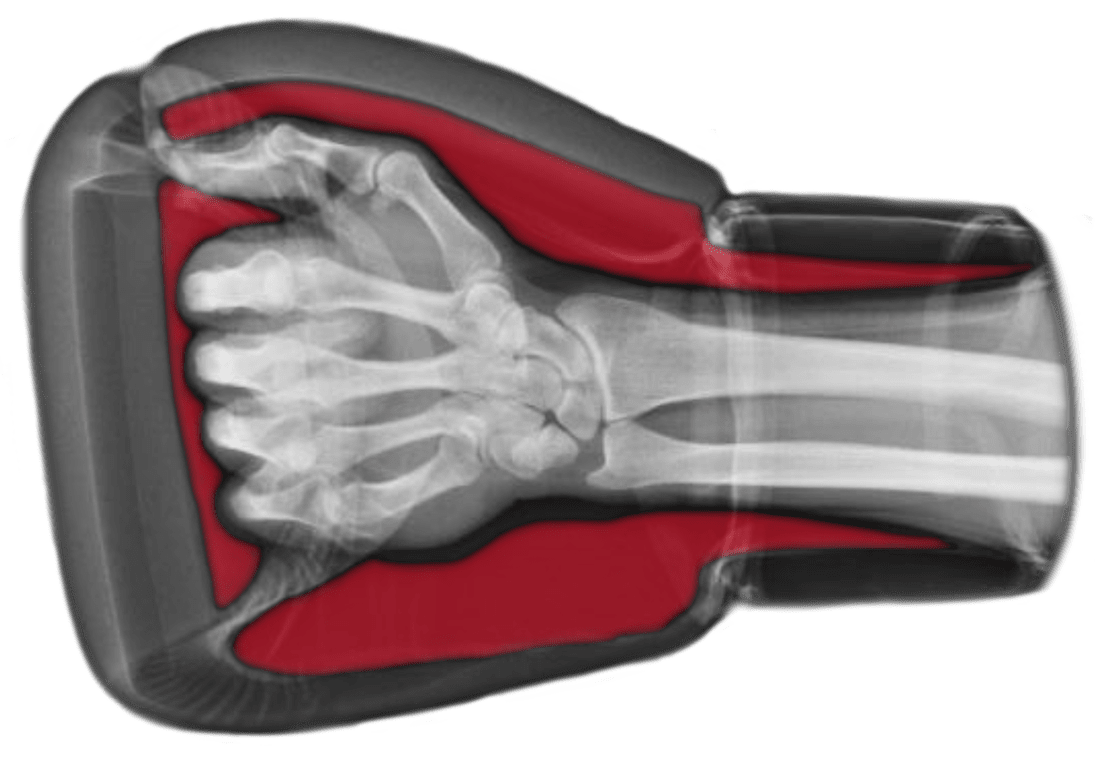 Can You Do Boxing Without Hand Wraps?